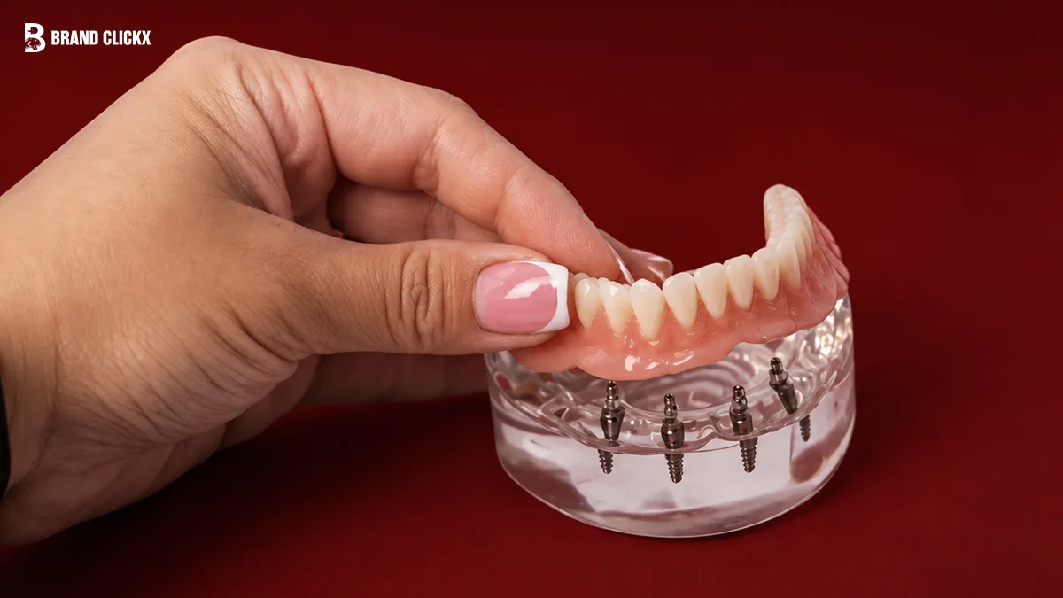 Hand holding an All-on-4 dental implant prosthesis against a dark red ambient background