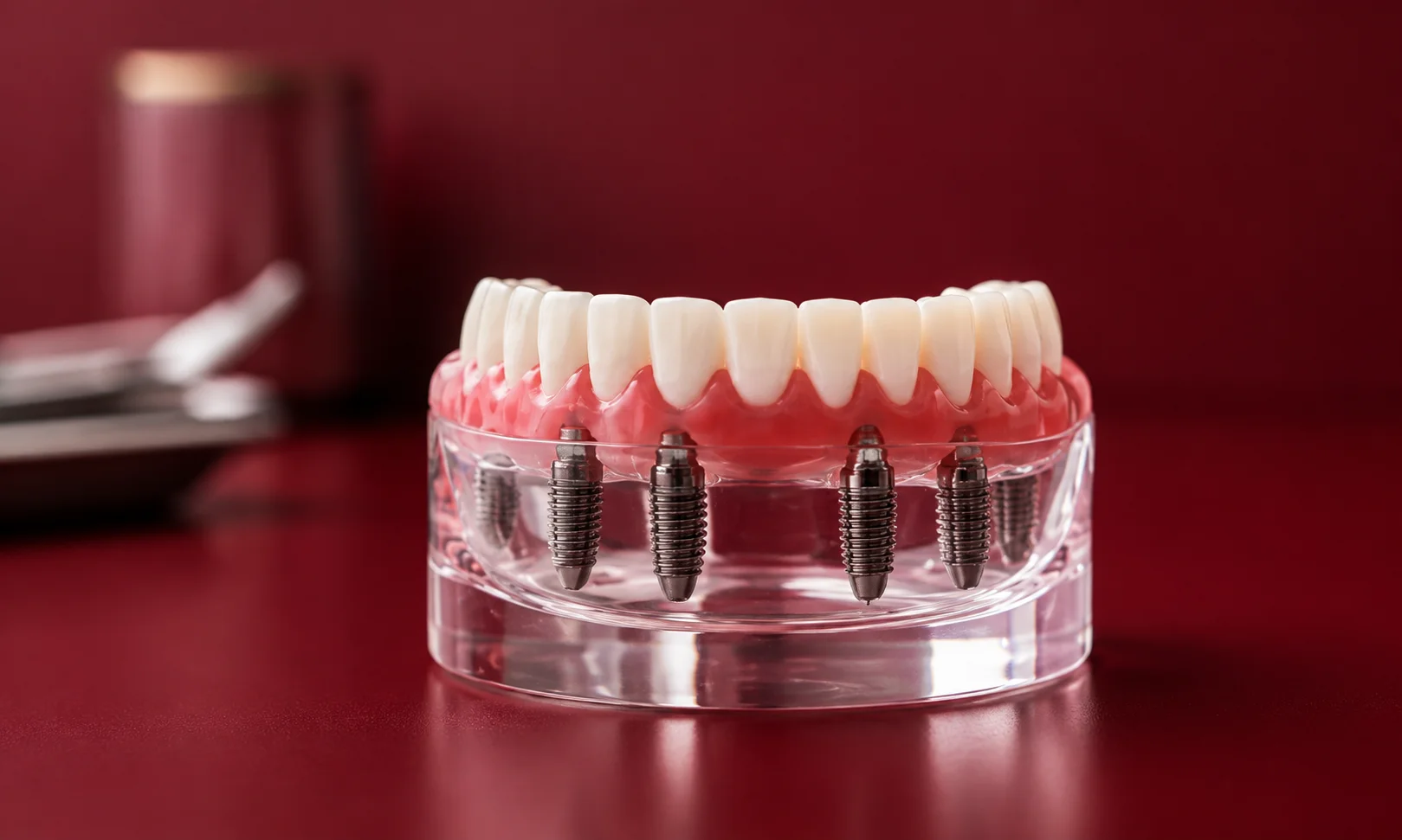 Dental arch model showcasing full-mouth restoration on a rich dark red tabletop